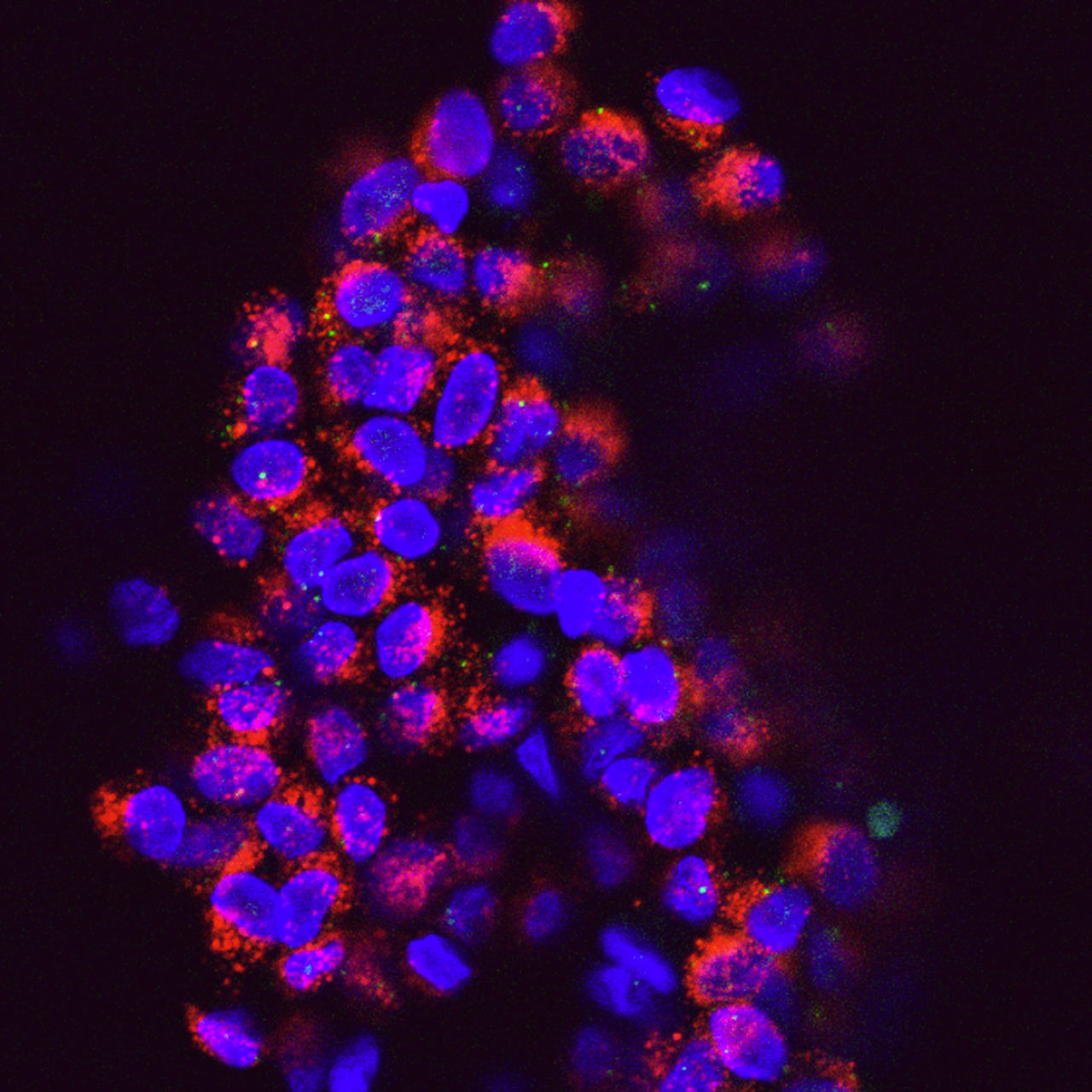 This cluster of circulating tumor cells (CTCs, shown in red) originated from the blood of a breast cancer patient. CTCs are an important focus of cancer research because they provide a key target for new treatments.