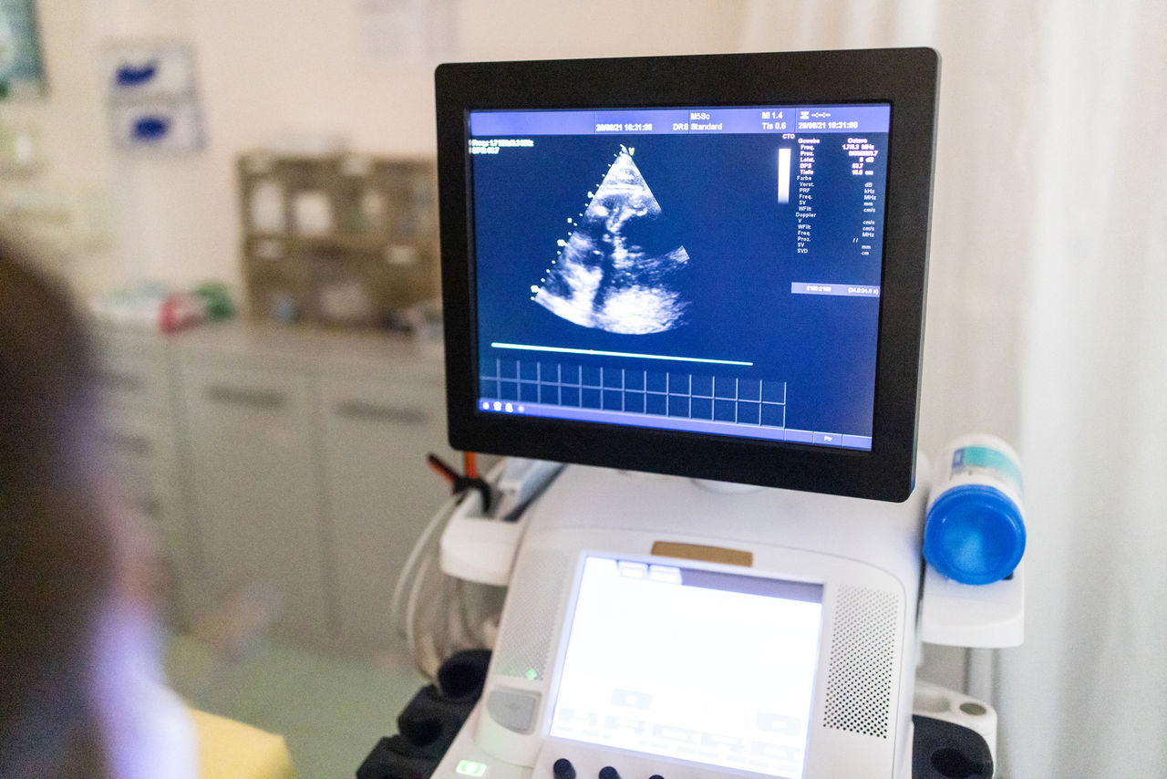 Ultrasound echocardiogram computer monitor in heart clinic