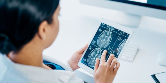 Doctor analysing brain scan