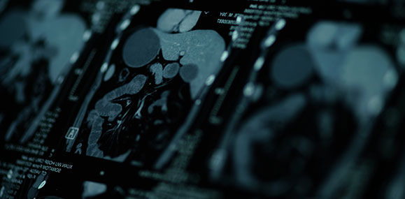 Cardiovascular Imaging