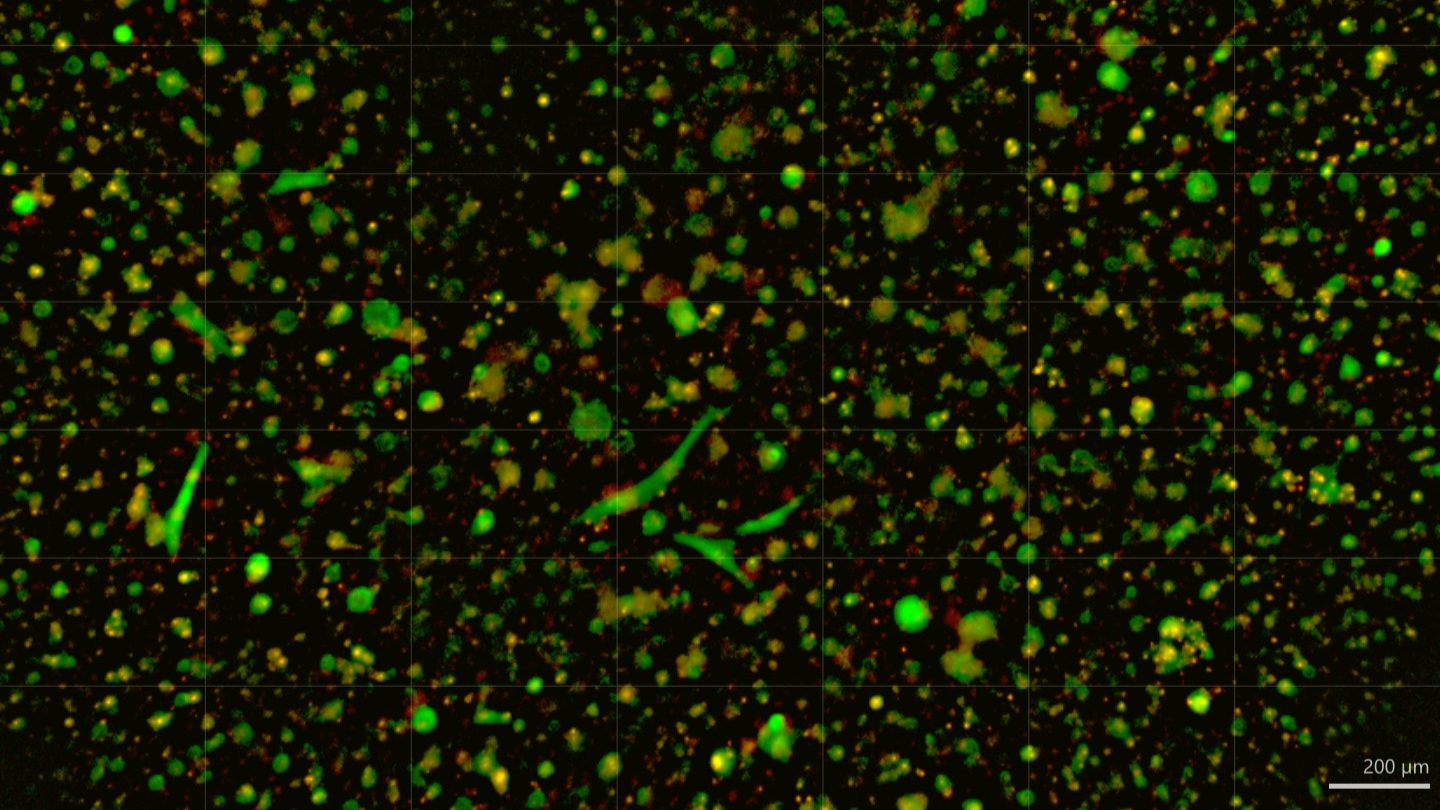 ChristianaCare Launches Organoid Core to Personalize Cancer Treatment