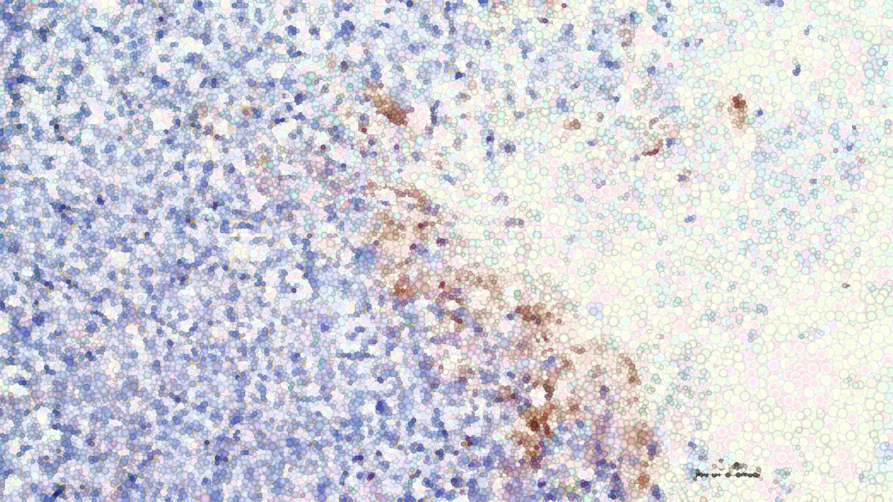 ChristianaCare Gene Editing Institute Achieves CRISPR Breakthrough That Reverses Chemotherapy Resistance in Lung Cancer
