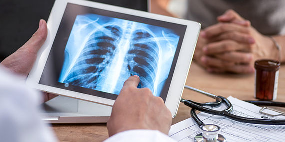 Un médico examina los resultados de una prueba de detección pulmonar en una tableta digital
