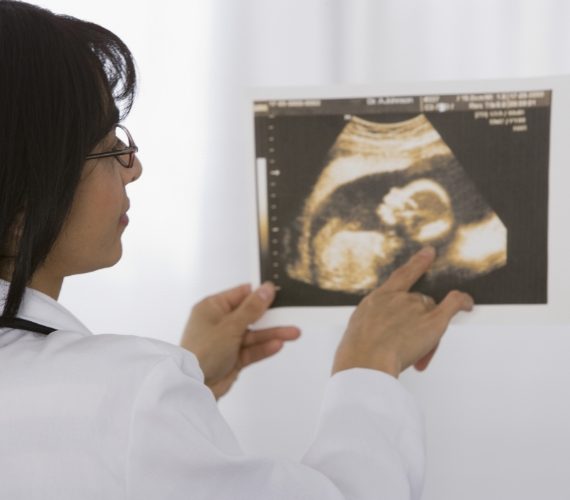 Doctor looking at contrast enhanced ultrasound
